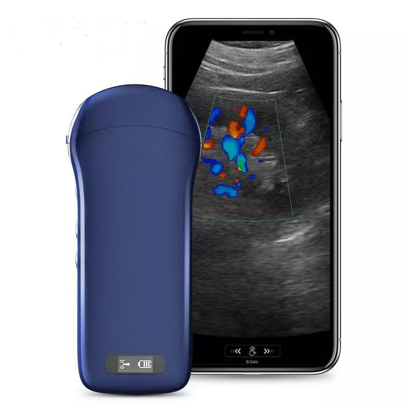 Portable Wireless Three in One Handheld