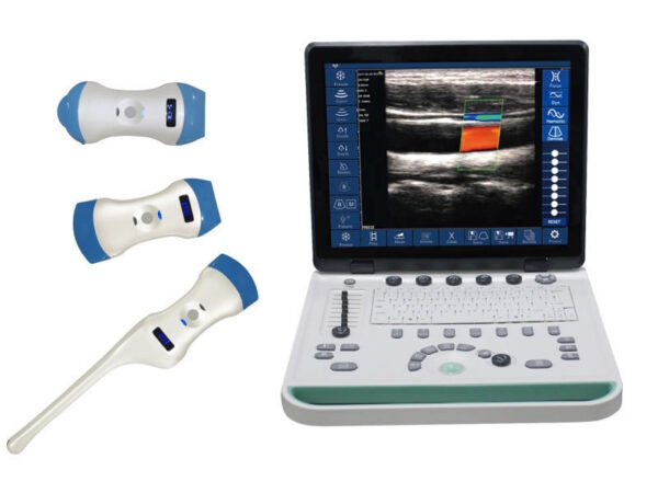 Three-in-One Plastic Electric Ultrasound Scanner Probe Wireless Class II Certified Multi-Mode Dia...
