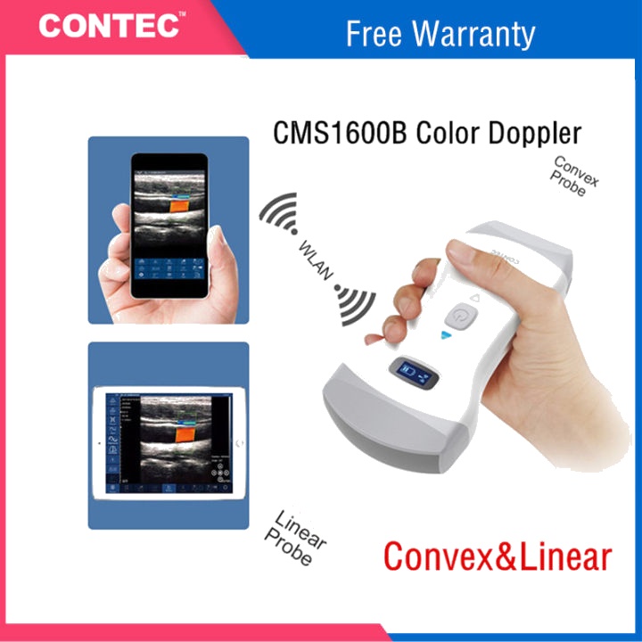 Color Doppler Wifi Wireless Ultrasound Linear Probe Wireless Ultrasound Electric Metal Hospital B...
