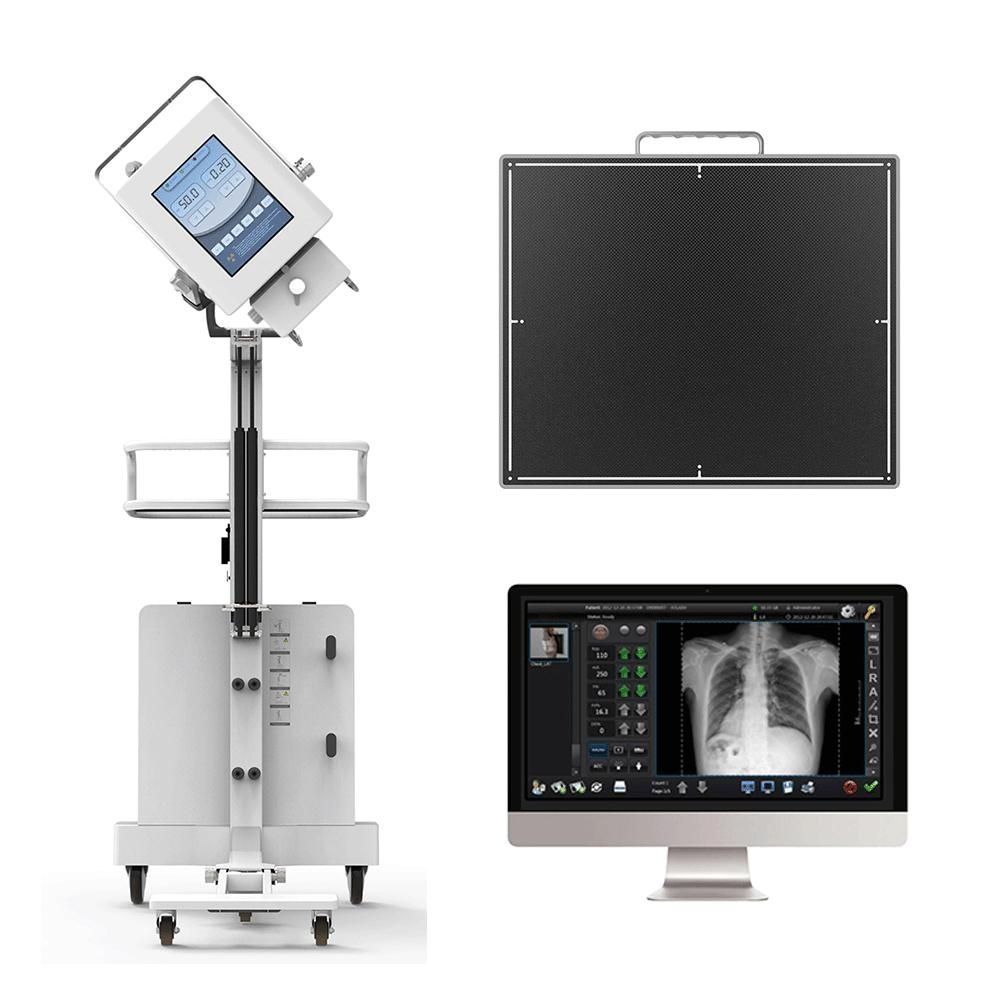 Medical 9.7 Inch Touch Screen DR X-ray Machine High Frequency Digital X Ray Machine