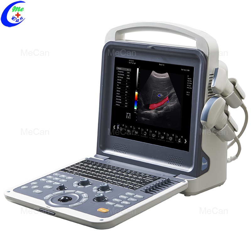 Portable Ultrasound System Medical Echocardiography 4D Color Doppler Ultrasound ...