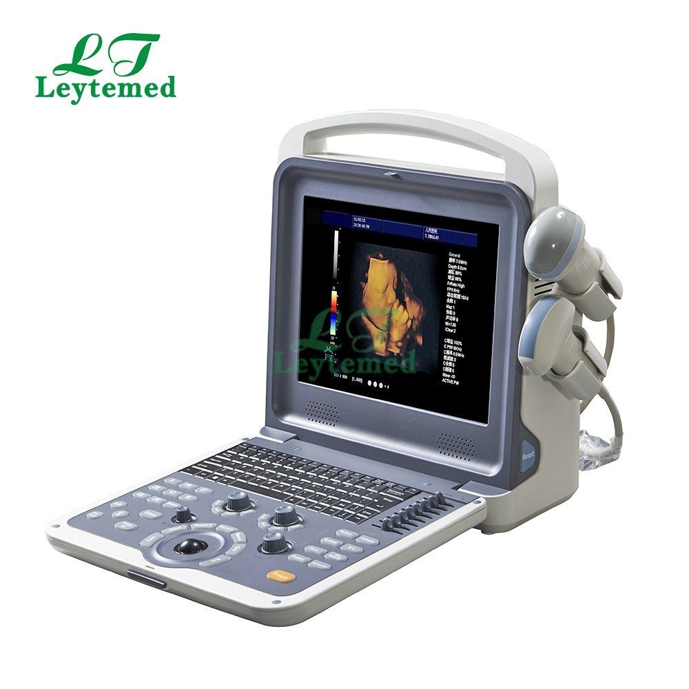 Portable 4D Ultrasound Machine for Pregnancy