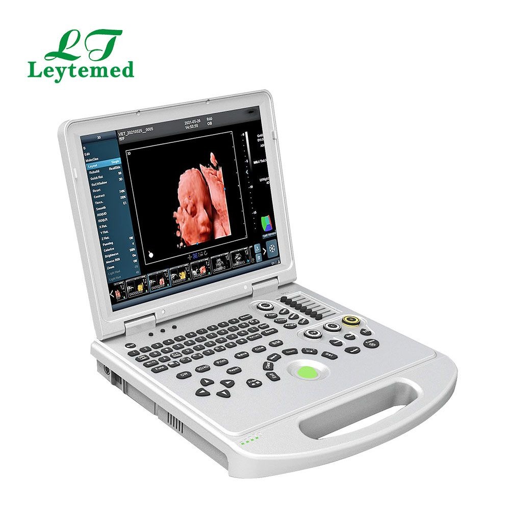 Portable Laptop Color Doppler Ultrasound Machine