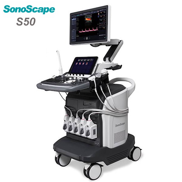 Sonoscope 4D Color Doppler Vascular Ultrasound Instrument Cardio Echo Vascular Trolley Medical Ul...