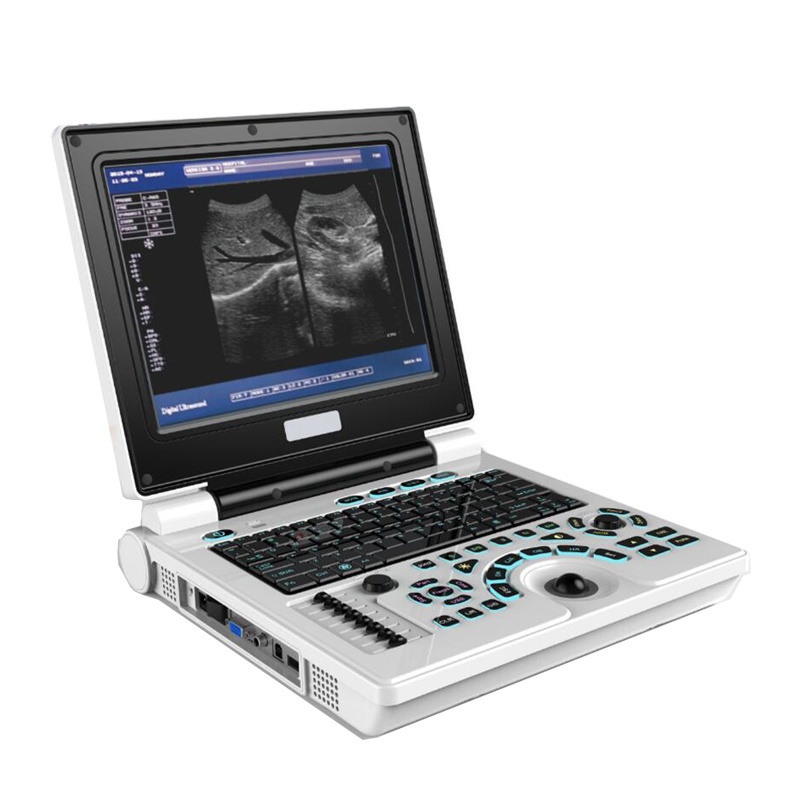 Medical Ultrasound Diagnostic Instruments Portable Laptop Black and White Ultrasound Scanner Mach...