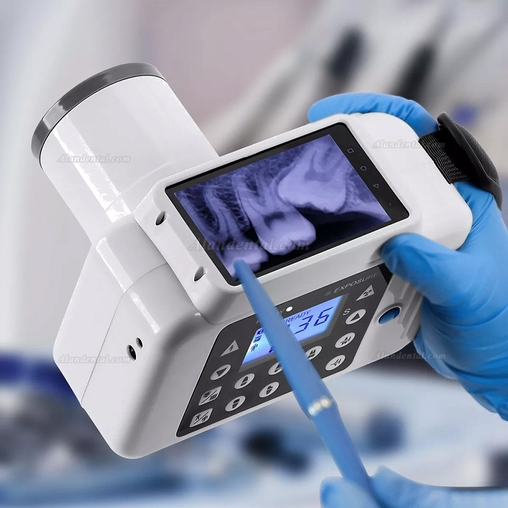 Hot-sale Smart Plus Portable X-ray Machine /dental X-ray Sensor
