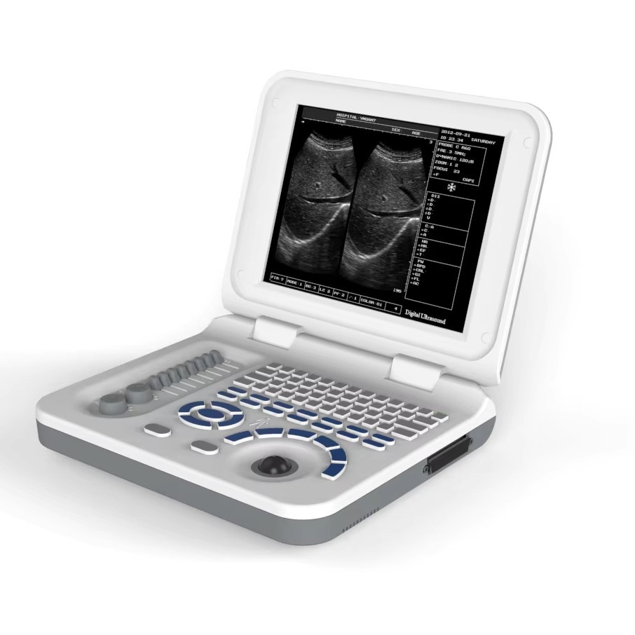 B/W Digital Ultrasound Scanner for Humans and Vets Laptop Ultrasound System for Diagnosis