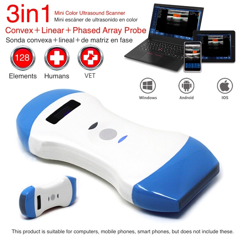Double Head 128 Element Ultrasound Three in One Color Doppler Handheld Mobile Cardiac Wireless Sc...